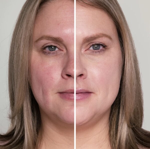 HydroPure™ Color Correcting Serum - Bilde 2