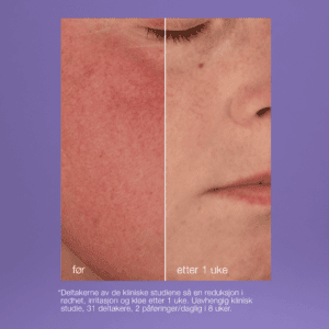 Ultracalming – Stabilizing repair cream 50 ml