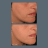 Pro-collagen banking serum - Bilde 3
