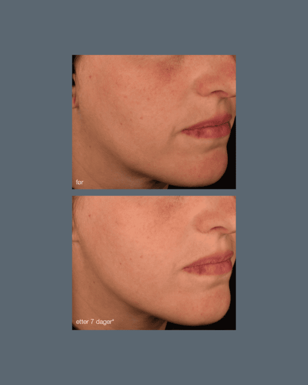 Pro-collagen banking serum - Bilde 3