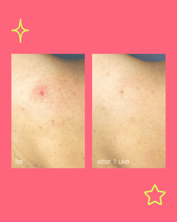 Clarifying body spray - Bilde 3