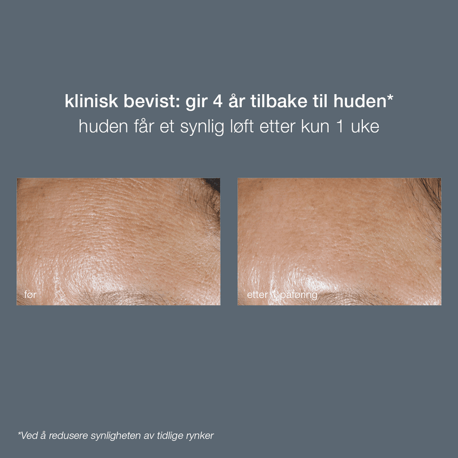 Phyto Nature Oxygen Cream - Bilde 2